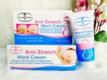 অ্যান্টি-স্ট্রেচ মার্ক ক্রিম
